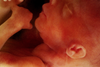 abortionbpas