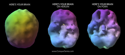 brain-image